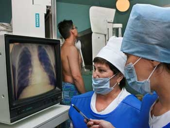 В Запорожской области усилят работу по выявлению и диагностике туберкулеза фото