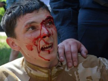 Запорожский доброволец пострадал на гей-параде в Киеве фото