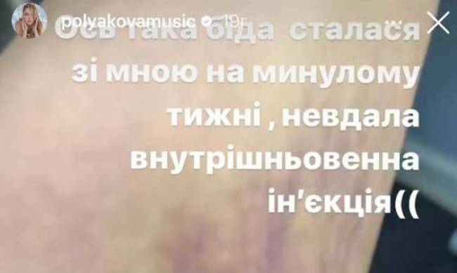 Ось така біда сталася: Полякова шокувала виглядом своєї руки після невдалої інєкції фото